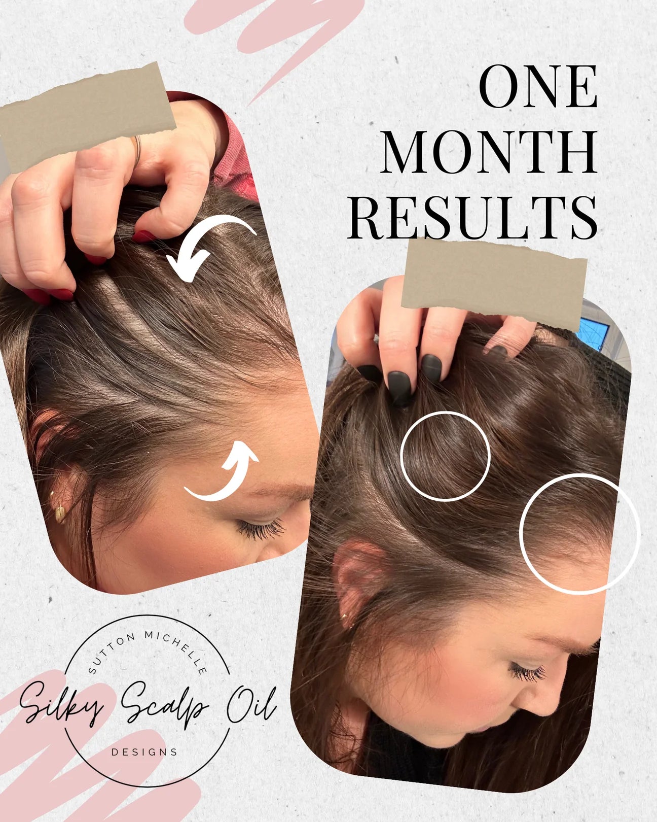 Sutton Michelle Growth Scalp Oil