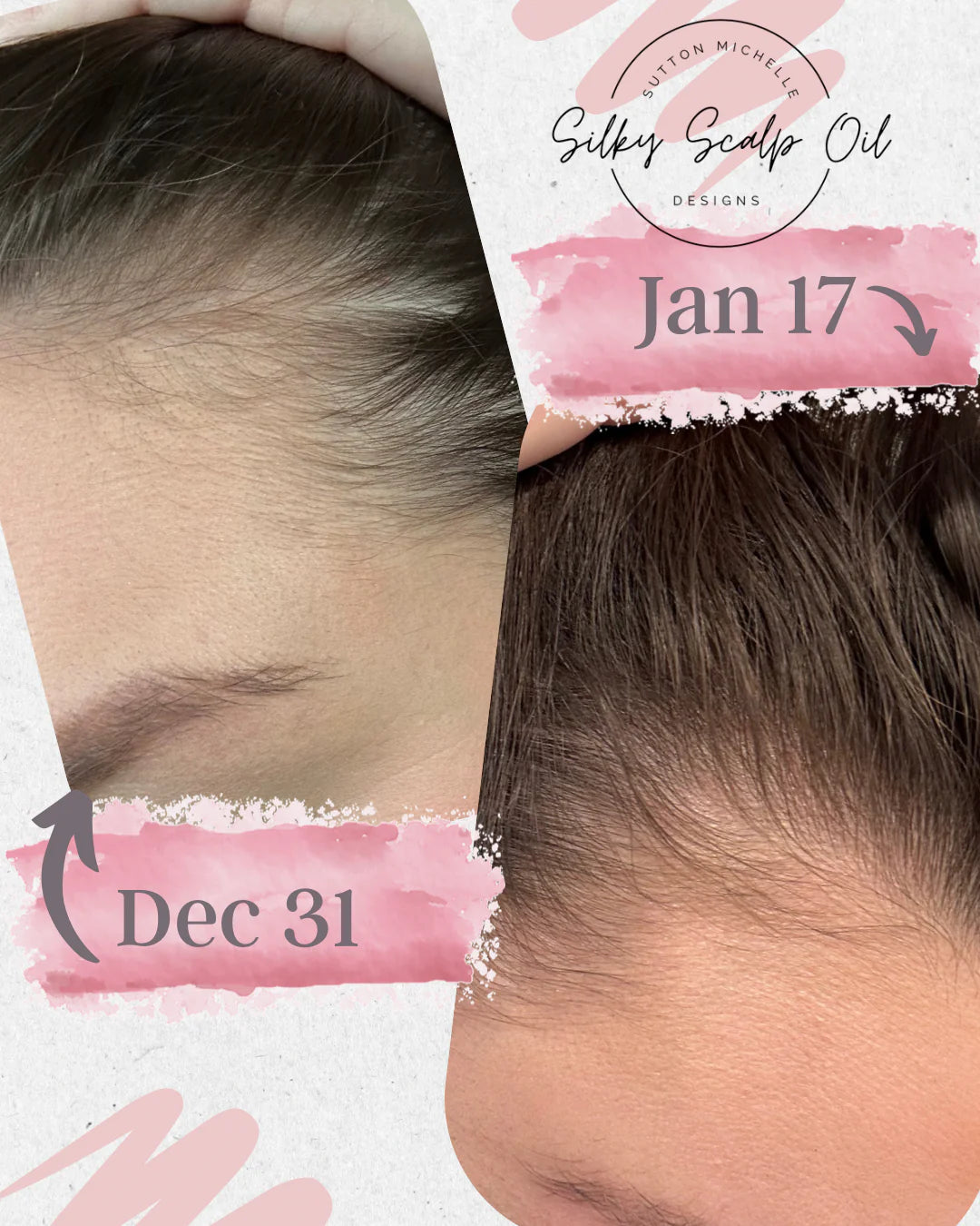 Sutton Michelle Growth Scalp Oil