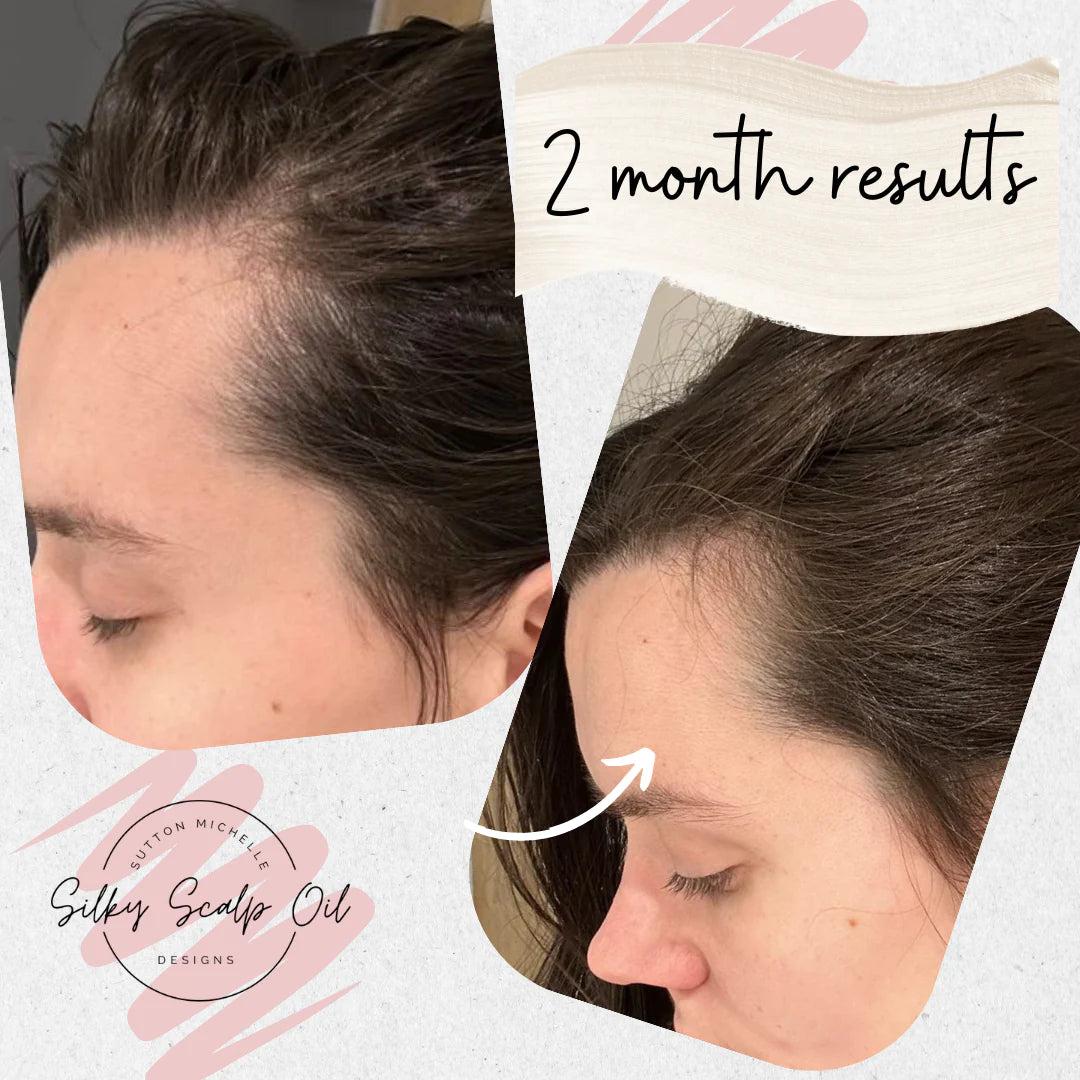 Sutton Michelle Growth Scalp Oil